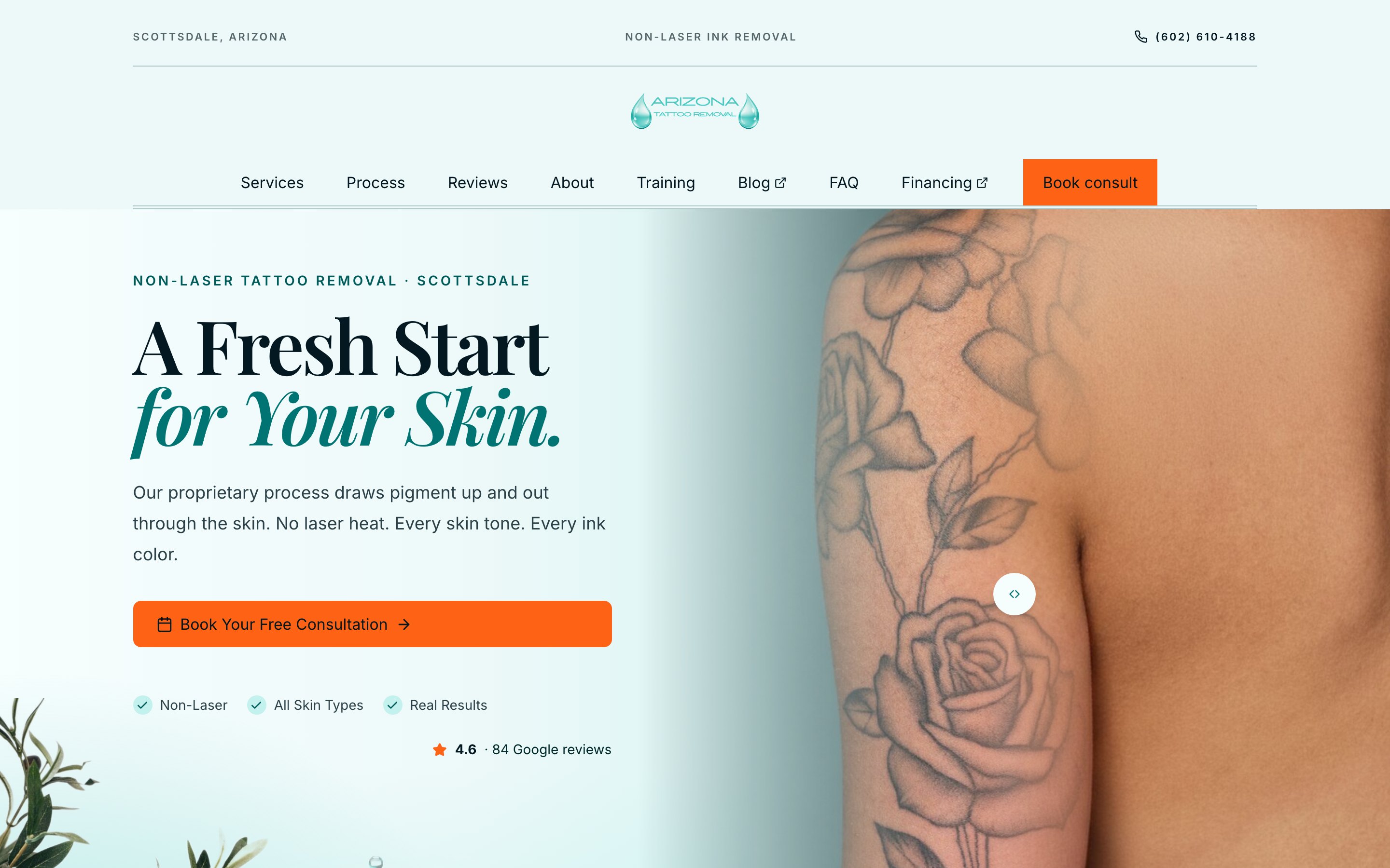 Arizona Tattoo Removal Scottsdale website built by Strategic Digital Media